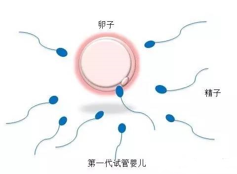 李雪梅